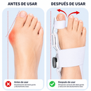 ALINEADOR DE JUANETE PREMIUM