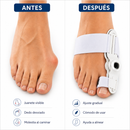 ALINEADOR DE JUANETE PREMIUM + CREMA REPARADORA DE PIES 🦶🎁