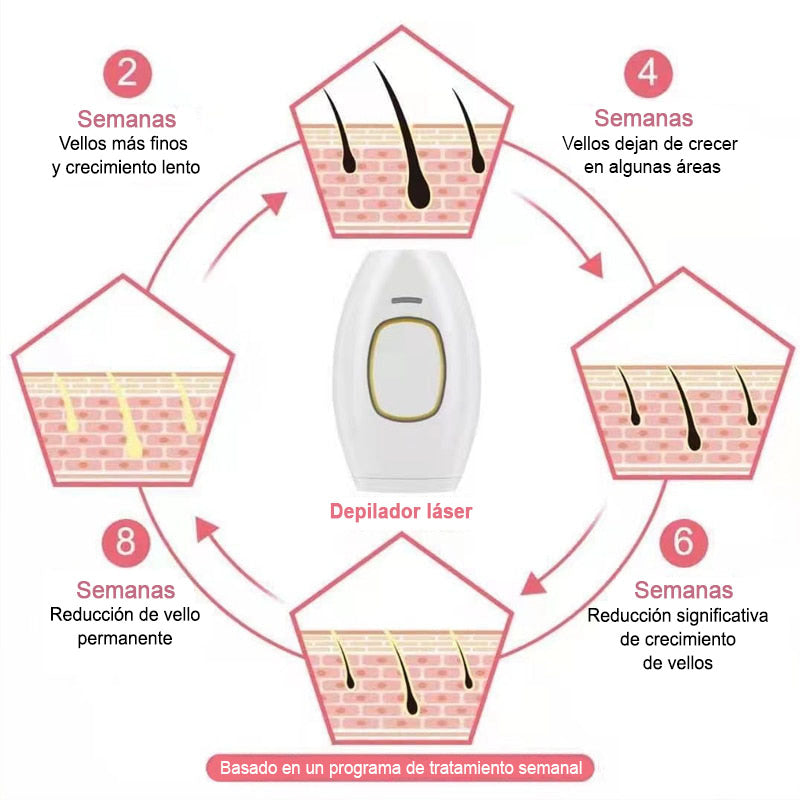 SoftSkin™ Depiladora Láser IPL