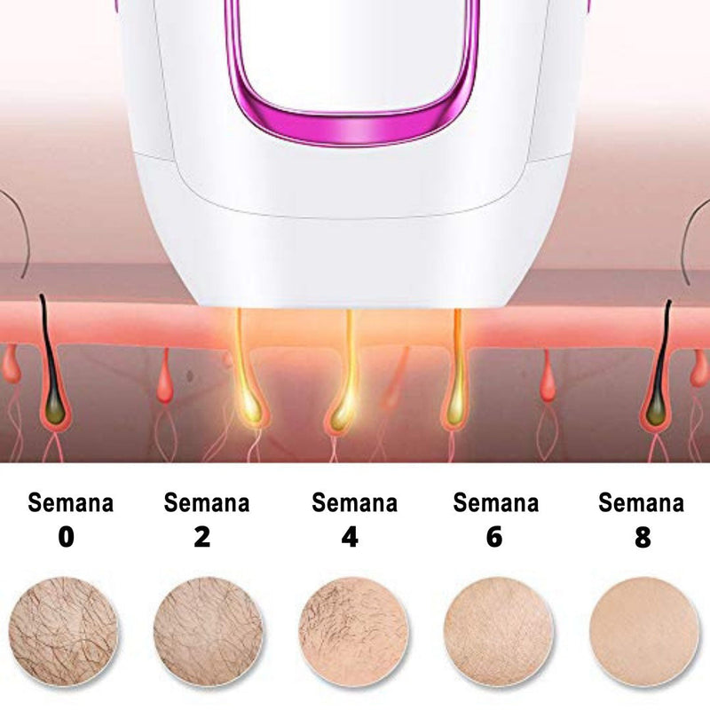 SoftSkin™ Depiladora Láser IPL